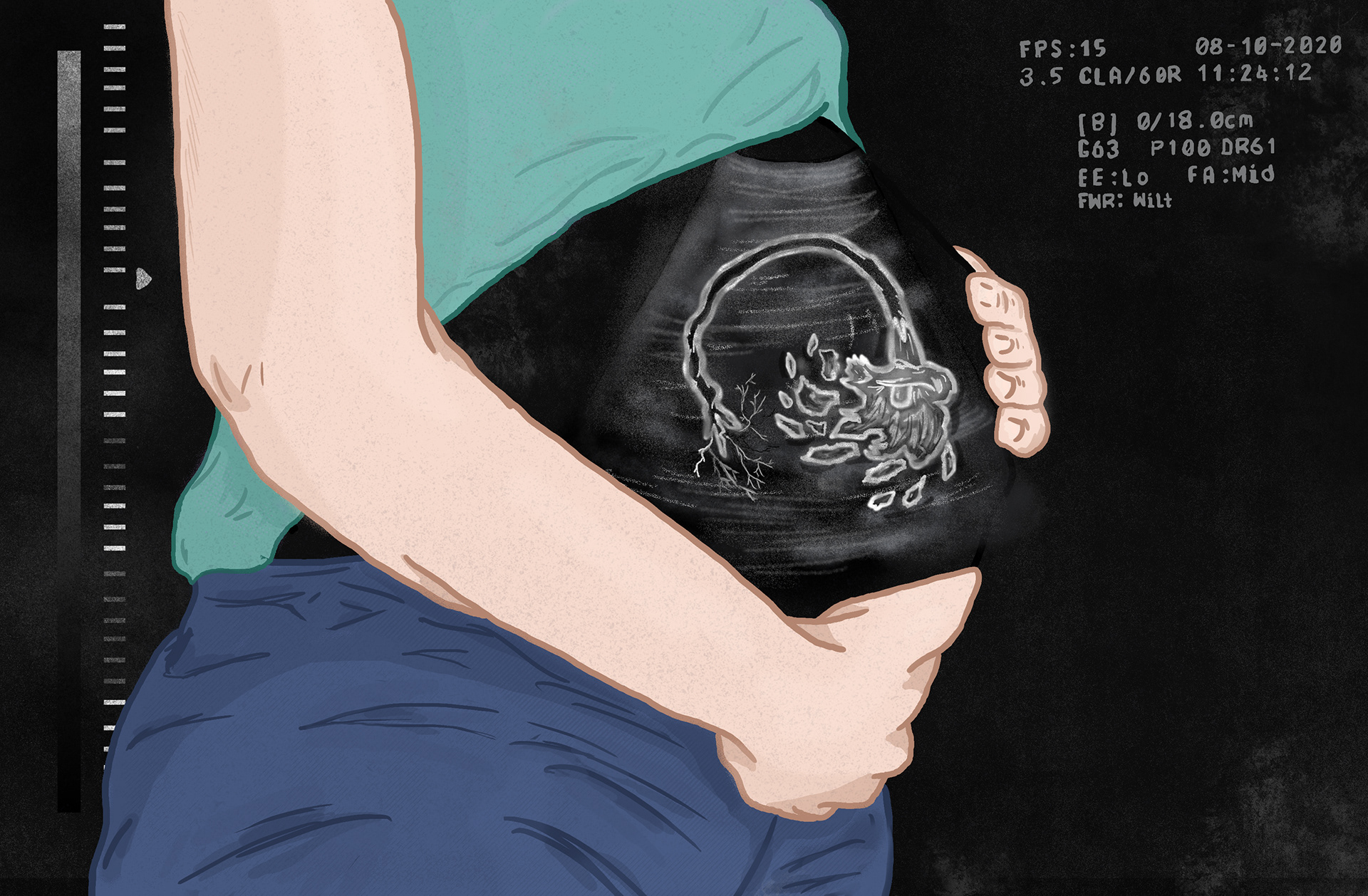 "Flowers" Irish Independent NIW Illustration