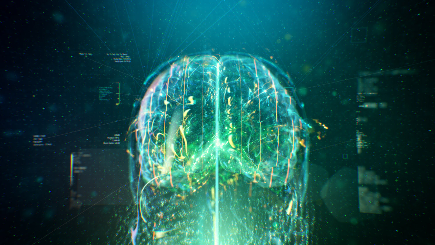 Our reference for how we plan to treat the brain in terms of x-ray and tech feel.
