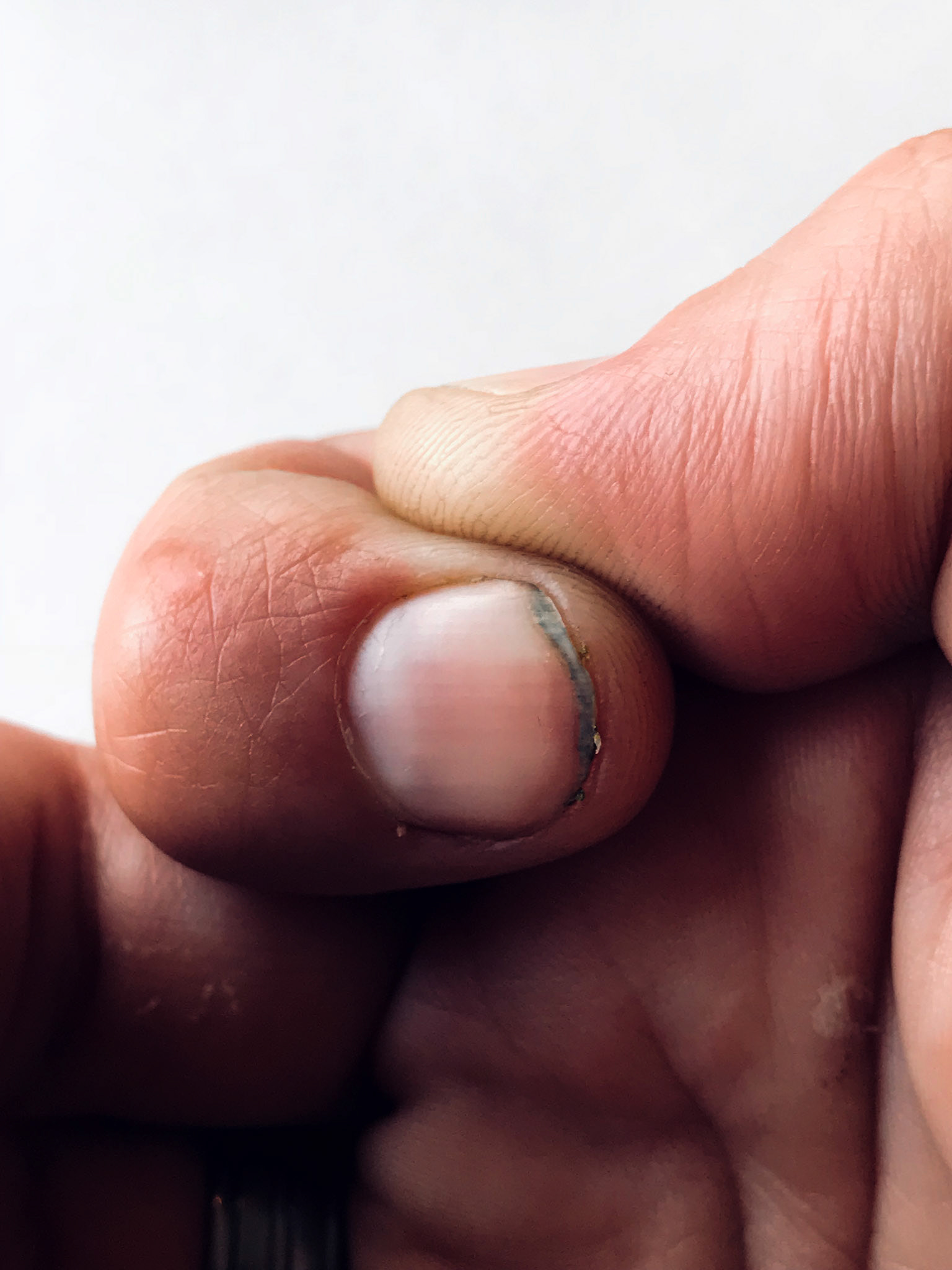 Dirty nail.