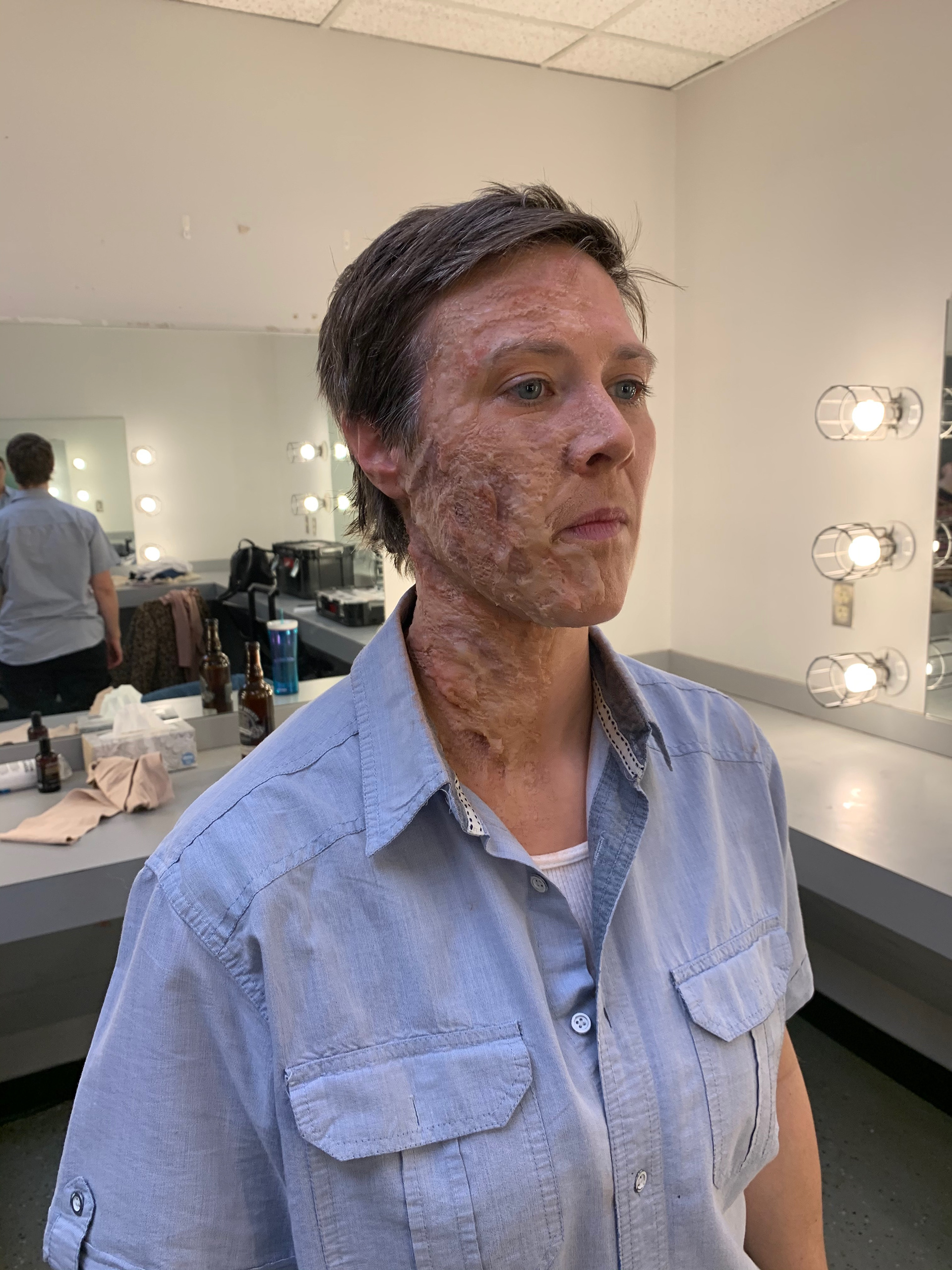 January 2020—Burned Aive