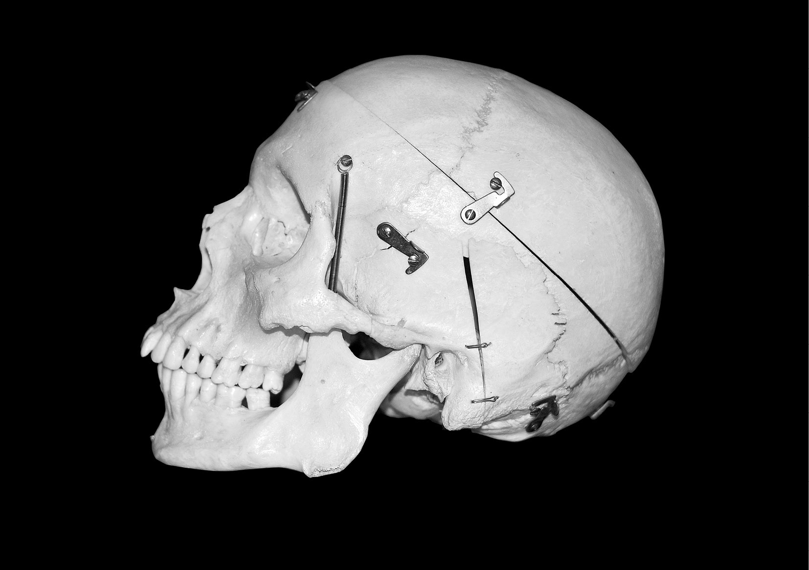 Black & White Skull | Digitale Fotoretusche