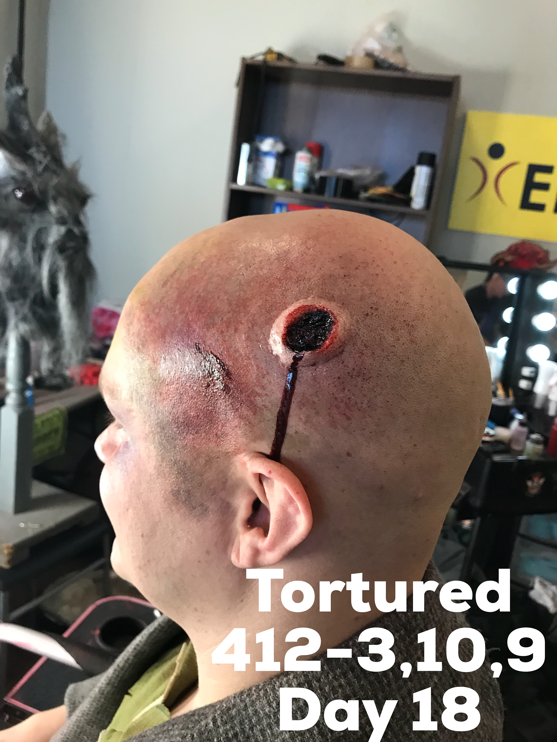 Entrance wound