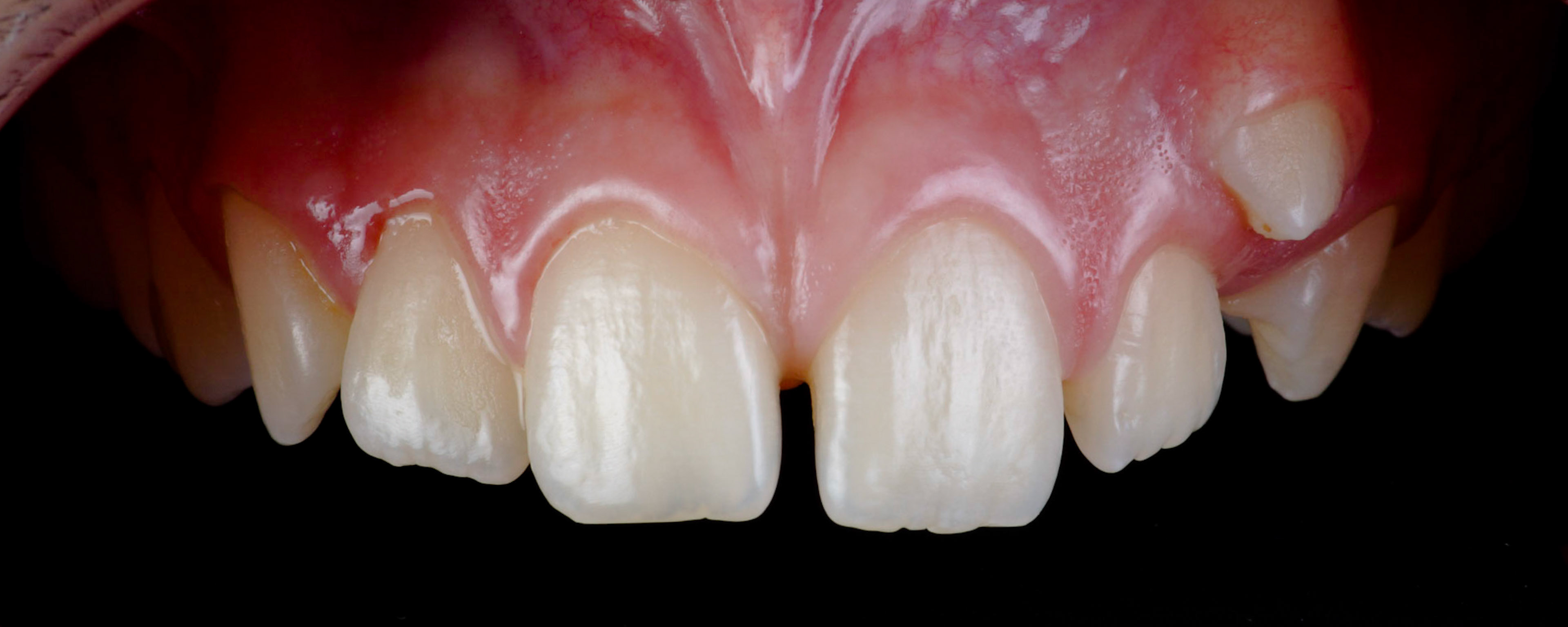 Milivoj Sherrington Dental Photography