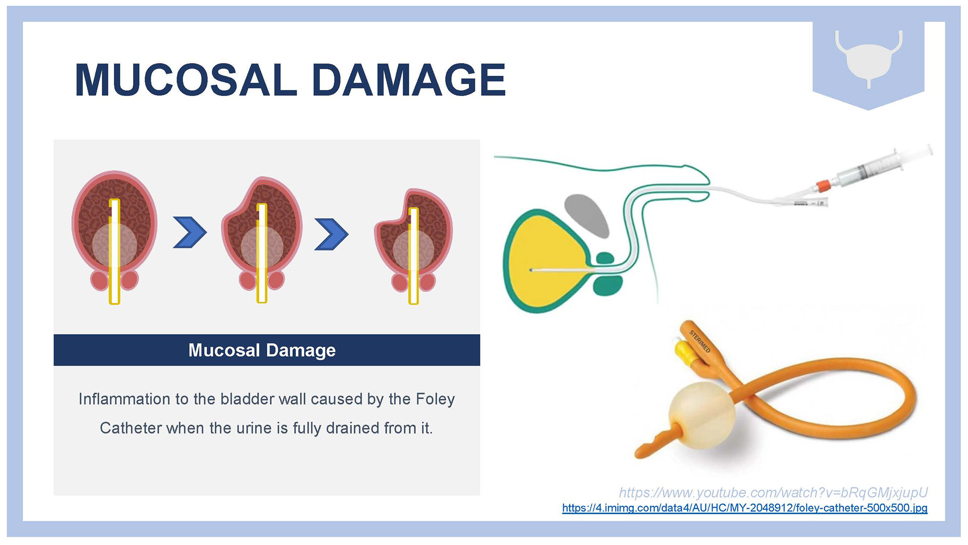 Normal catheters cause mucosal damage to the membrane as found in some literary articles.