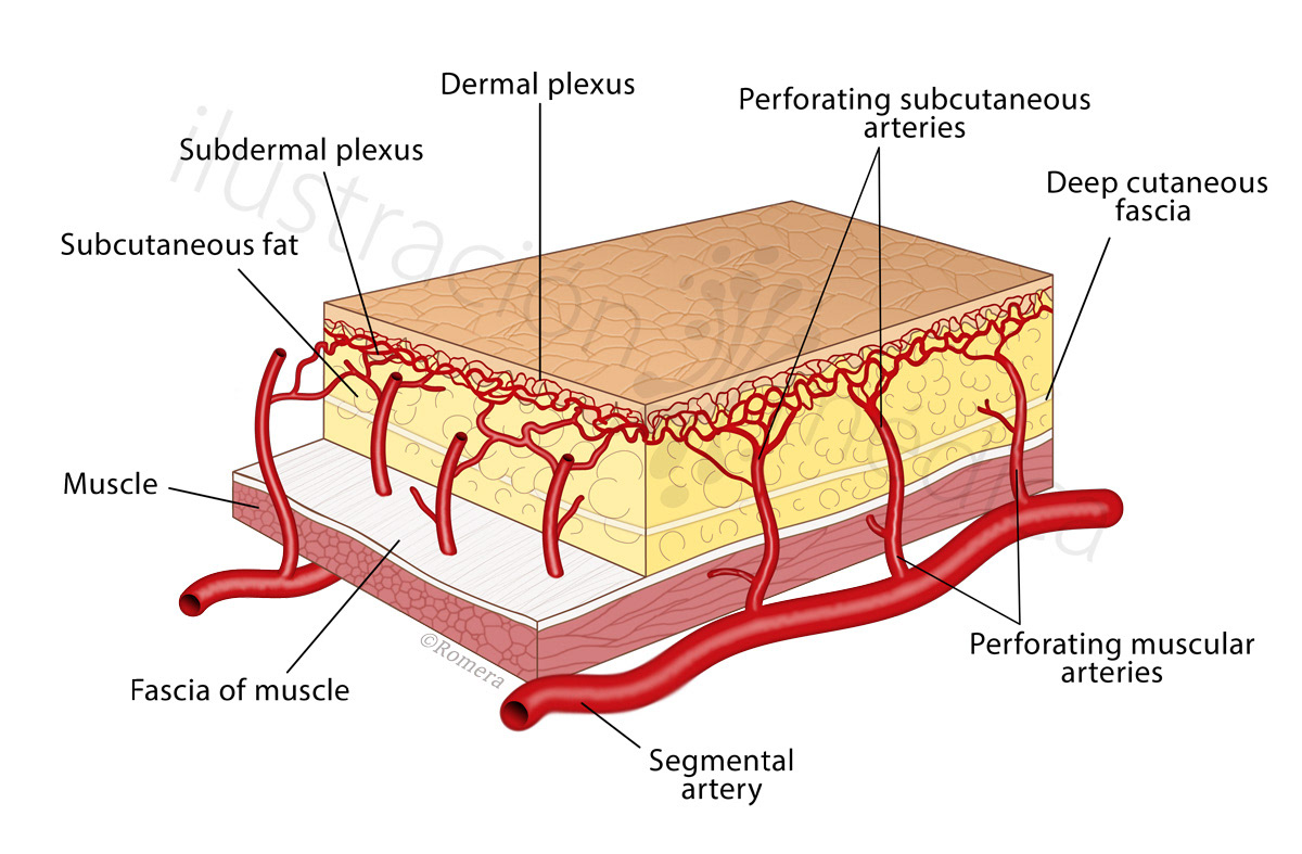 Manuel Romera, medical illustrator - Colgajo de perforantes intercostales