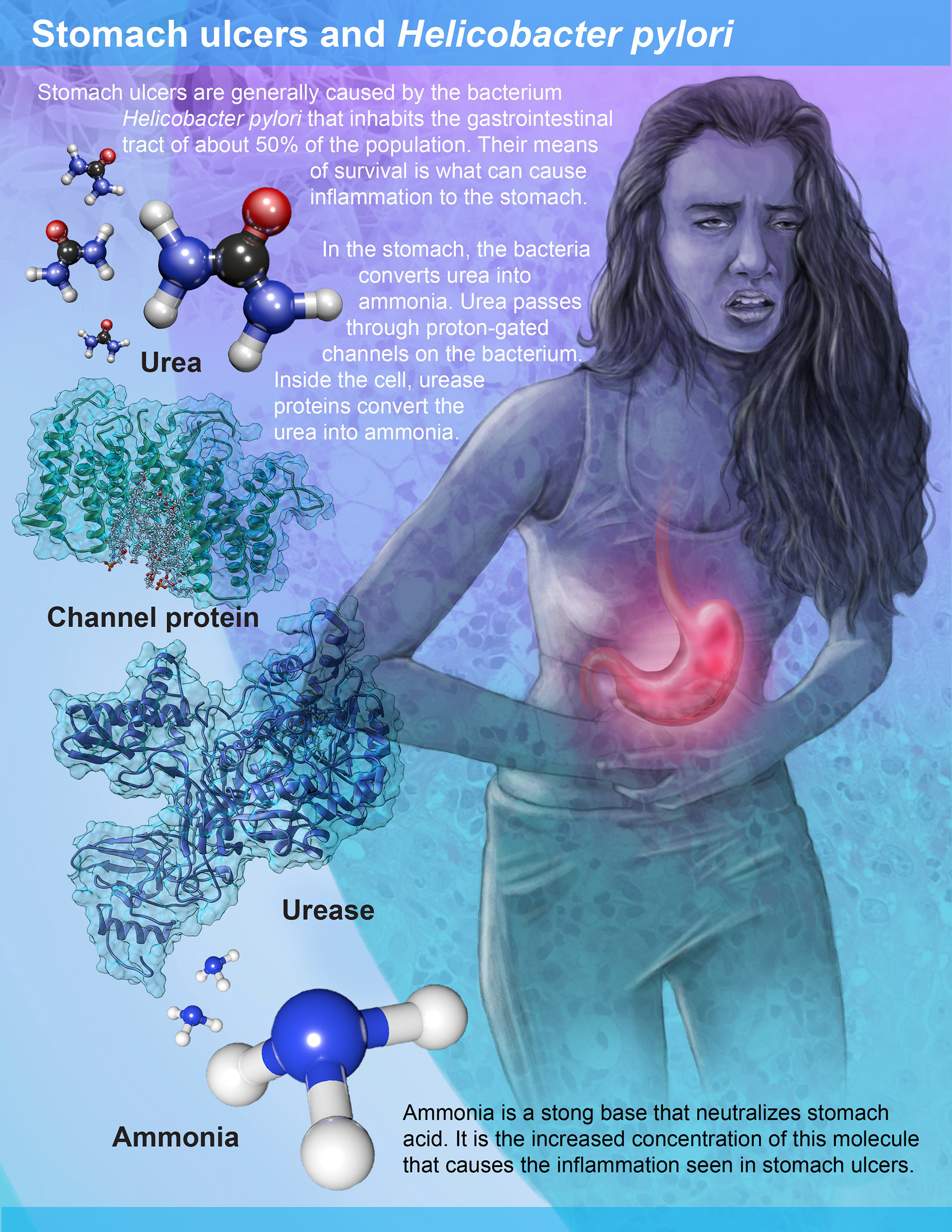 Stomach ulcers and the chemical processes of Helicobacter pylori bacteria illustrated in Adobe Photoshop and models created in VMD, Chimera and textured in Cinema 4D (2015)