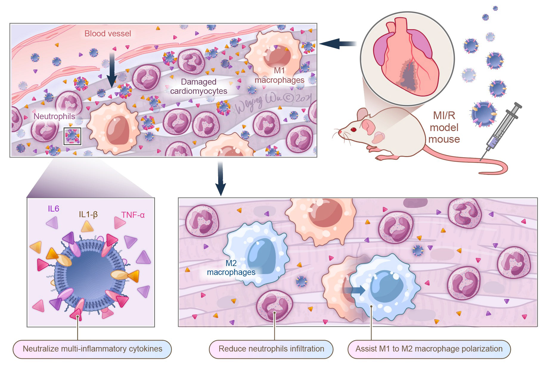 nanoparticles binding to the inflammatory cytokins