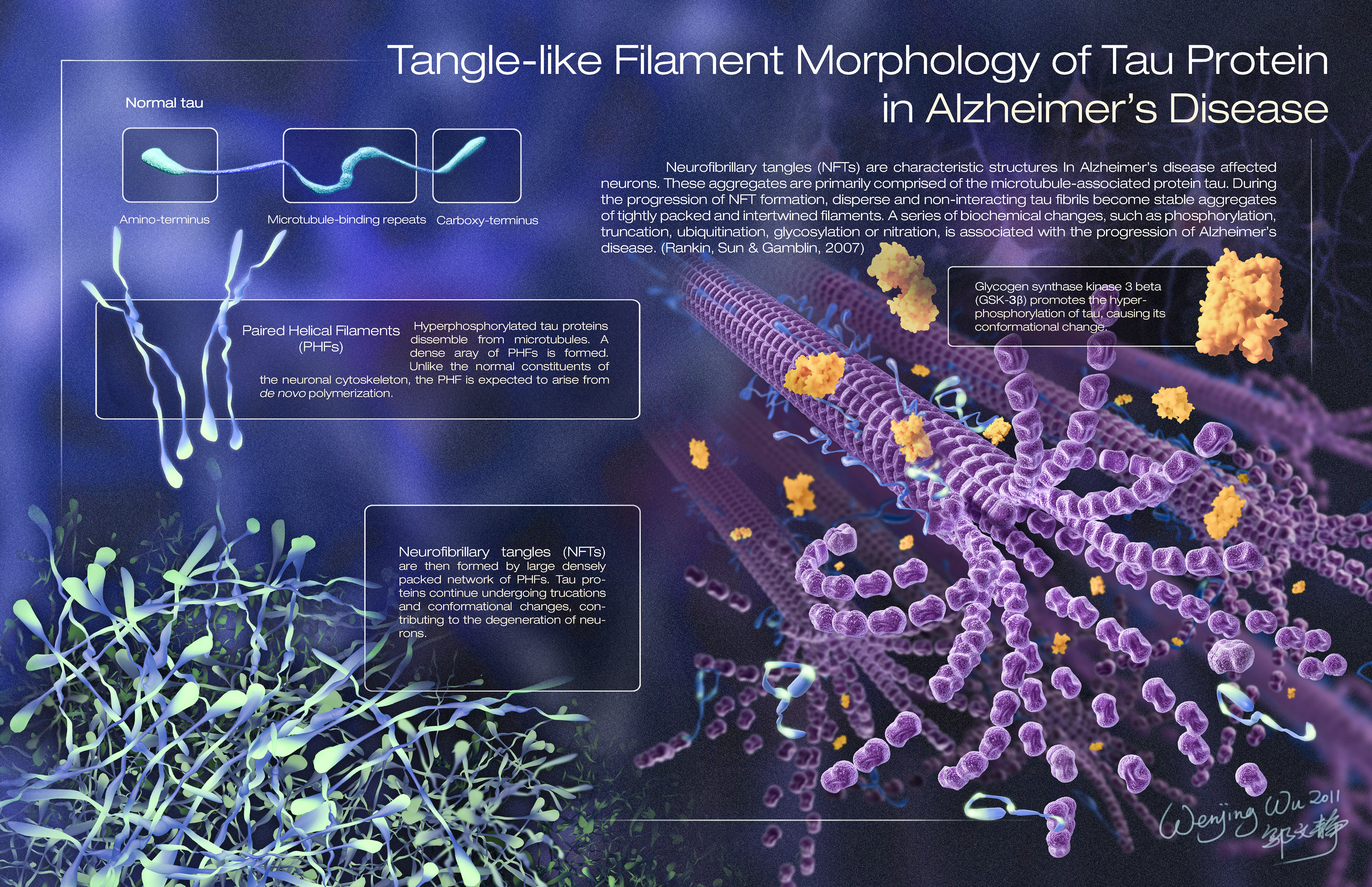 tau protein in alzheimer's disease